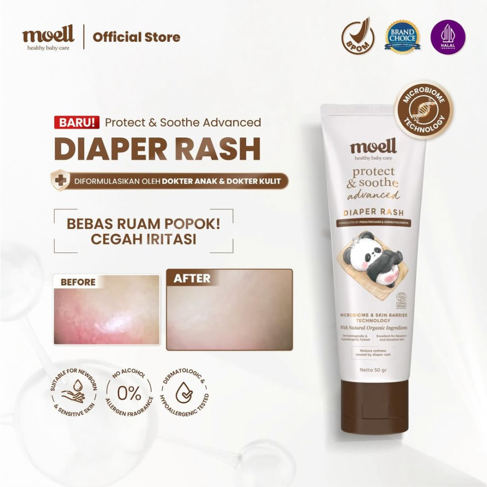 MOELL DIAPER RASH 50 G